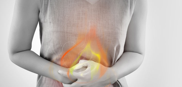 Heartburn & Reflux Center