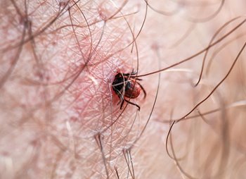 Tick biting person
