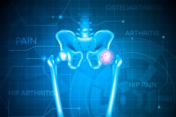 Door County Hip Orthopedic Care