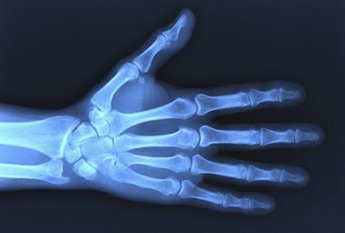Door County Orthopedic Hand Treatment
